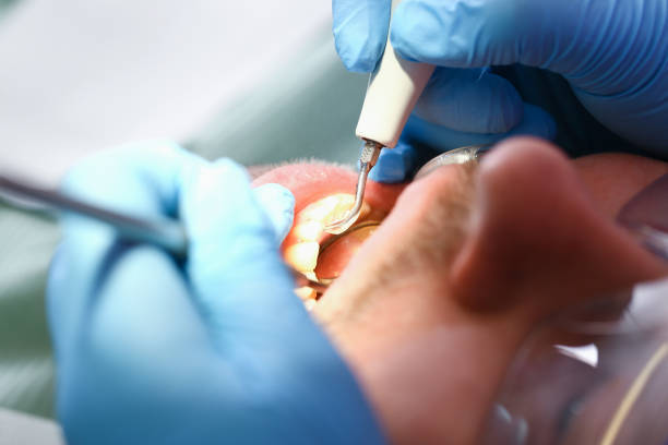 Best Pediatric Emergency Dentist in Buhler, KS